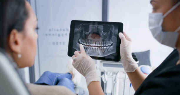 Licensed Root Canal Treatment service in Fond du Lac, WI - Smile Center Dentistry